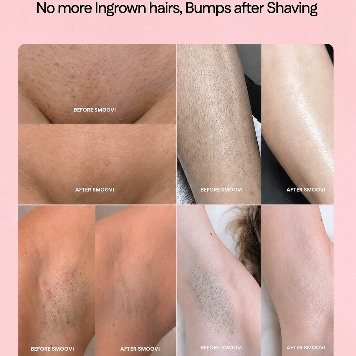 Velvet Glide | 2-in-1 Men & Women Body Shaver